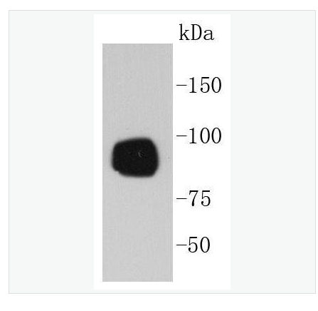 Anti-Phospho-RPS6KA1  antibody-磷酸化絲氨酸/蘇氨酸激酶p90RSK蛋白重組兔單克隆抗體,Phospho-RPS6KA1 (Ser380)