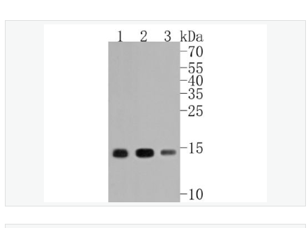 Anti-Histone H3 antibody-乙酰化组蛋白3（K14）重组兔单克隆抗体,Histone H3 (acetyl K14)