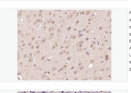 Anti-Nur77 antibody-孤兒核受體蛋白Nur77抗體,Nur77