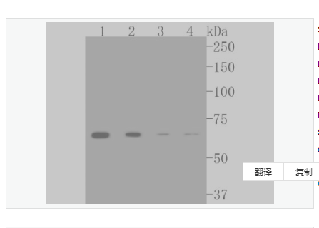 Anti-CPT2 antibody-肉毒碱棕榈酰基转移酶2重组兔单克隆抗体,CPT2