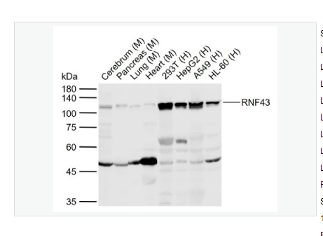 Anti-RNF43 antibody-环指蛋白43抗体,RNF43