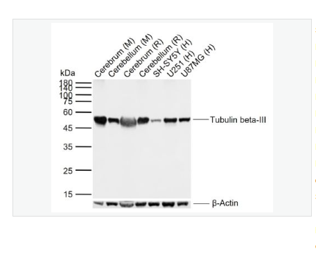 Anti-Tubulin beta-III antibody-微管蛋白β3重组兔单克隆抗体,Tubulin beta-III