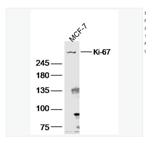 Anti-Ki-67  antibody-Ki67蛋白抗体