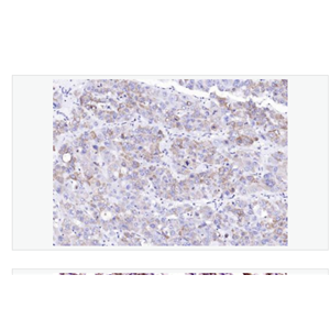Anti-Collagen II antibody-Ⅱ型胶原α1蛋白/软骨钙素单克隆抗体