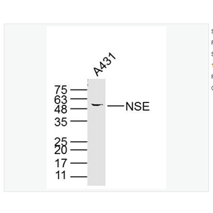 Anti-NSE antibody-神经元特异性烯醇化酶单克隆抗体