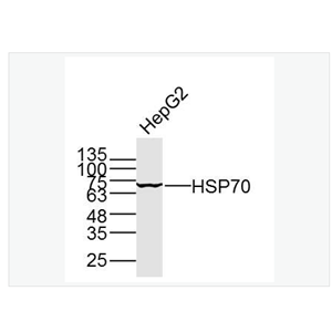 Anti-HSP70  antibody-热休克蛋白-70单克隆抗体