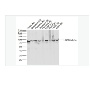 Anti-HSP90 alpha antibody-热休克蛋白90α单克隆抗体