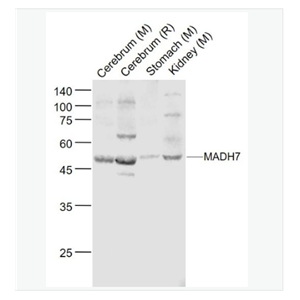 Anti-SMAD7 antibody-Smad7抗体