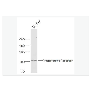 Anti-Progesterone Receptor antibody-孕激素受体抗体