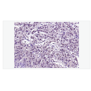 Anti-BRAF antibody-B Raf抗體,BRAF