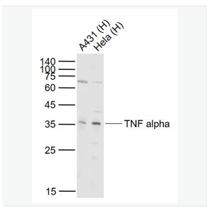Anti-TNF alpha antibody-人肿瘤坏死因子,TNF alpha