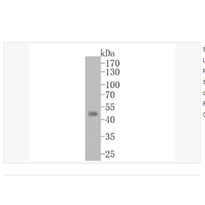 Anti-Aurora A  antibody-有絲分裂激酶A與重組兔單克隆抗體,Aurora A