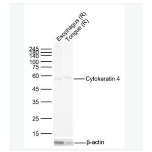Anti-Cytokeratin 4 antibody-细胞角蛋白4重组兔单克隆抗体