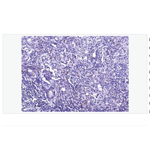 Anti-phospho-EGFR  antibody-磷酸化表皮生长因子受体重组兔单克隆抗体