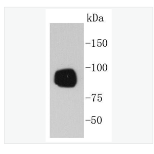 Anti-Phospho-RPS6KA1  antibody-磷酸化丝氨酸/苏氨酸激酶p90RSK蛋白重组兔单克隆抗体