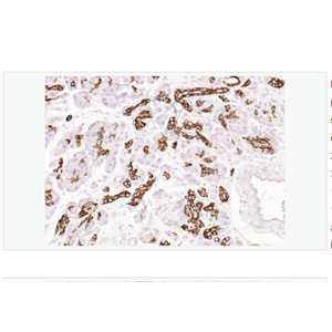 Anti-Cytokeratin 19  antibody-人细胞角蛋白19单克隆抗体