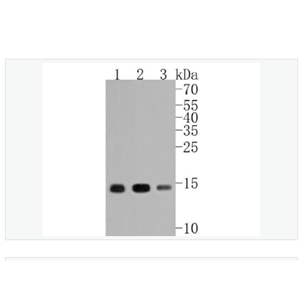 Anti-Histone H3 antibody-乙酰化组蛋白3（K14）重组兔单克隆抗体