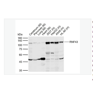 Anti-RNF43 antibody-环指蛋白43抗体,RNF43