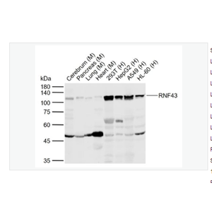 Anti-RNF43 antibody-環(huán)指蛋白43抗體