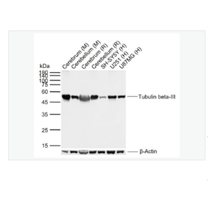 Anti-Tubulin beta-III antibody-微管蛋白β3重组兔单克隆抗体,Tubulin beta-III