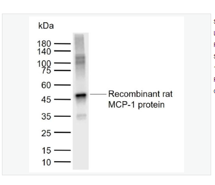 Anti-MCP1  antibody-单核细胞趋化蛋白1抗体,MCP1