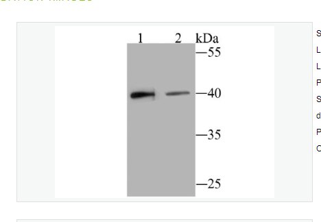 Anti-BST2 antibody-骨髓基质干细胞抗原2重组兔单克隆抗体,BST2