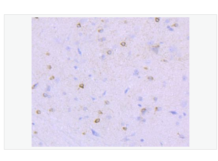 Anti-NMDAR1 antibody-離子型谷氨酸受體1重組兔單克隆抗體,NMDAR1