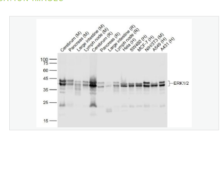 Anti-ERK1/2 antibody-丝裂原活化蛋白激酶1/ERK 1/2重组兔单克隆抗体,ERK1/2