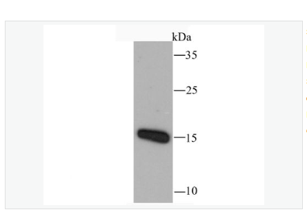 Anti-RANTES  antibody-T细胞特异性趋化因子重组兔单克隆抗体,RANTES