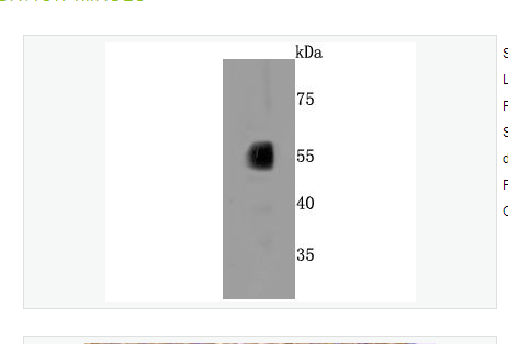 Anti-CYP2E1 antibody-细胞色素P450ⅡE1重组兔单克隆抗体,CYP2E1