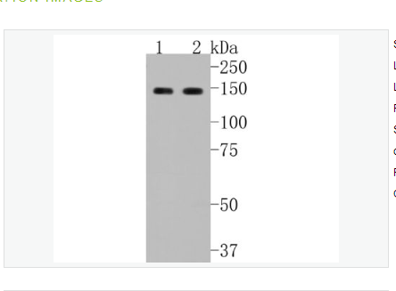 Anti-GLI1 antibody-脑胶质瘤相关蛋白重组兔单克隆抗体,GLI1