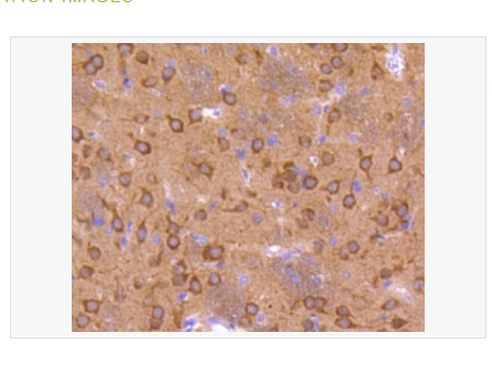 Anti-phospho-GSK3 Alpha + Beta antibody-磷酸化糖原合酶激酶3α/β重组兔单克隆抗体,phospho-GSK3 Alpha + Beta (Tyr279+Tyr216)