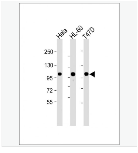 Anti-EZH2 antibody-抑癌蛋白EZH2单克隆抗体,EZH2