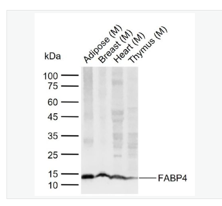 Anti-FABP4 antibody-脂肪细胞型脂肪酸结合蛋白4重组兔单克隆抗体,FABP4