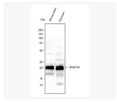 Anti-SNAP25 antibody-突触相关蛋白25重组鼠单克隆抗体,SNAP25