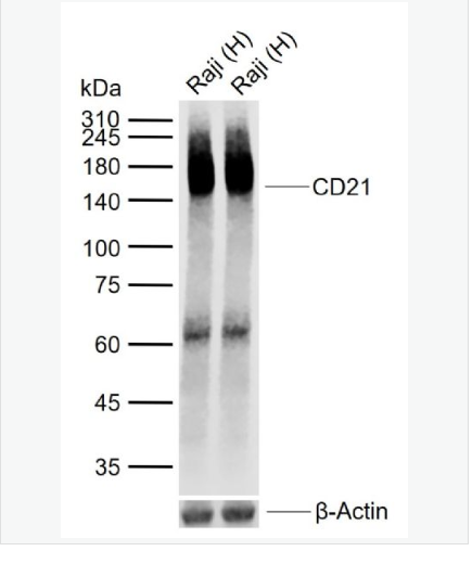 Anti-CD21 antibody-CR2重组兔单克隆抗体,CD21