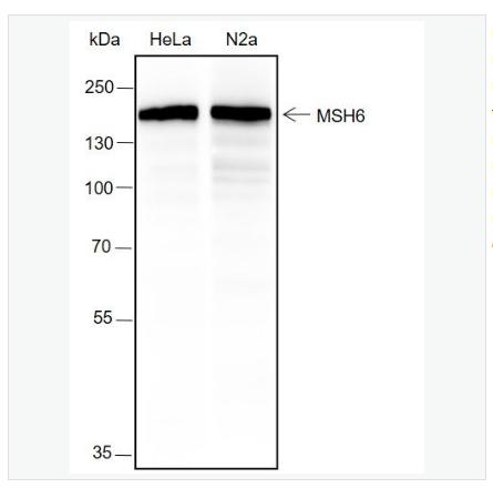 Anti-MSH6 antibody-错配修复蛋白6重组兔单克隆抗体,MSH6