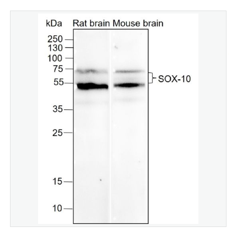 Anti-SOX-10 antibody-转录因子SOX10重组兔单克隆抗体,SOX-10