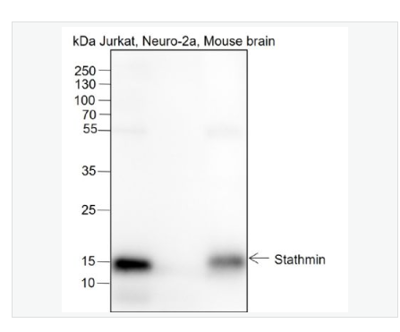 Anti-STMN1 antibody-白血病相关蛋白18/癌蛋白18重组兔单克隆抗体,STMN1