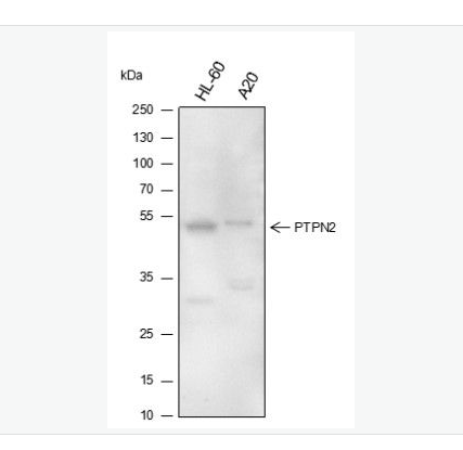 Anti-PTPN2 antibody-酪氨酸蛋白磷酸酶非受体2型单克隆抗体,PTPN2