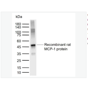 Anti-MCP1  antibody-单核细胞趋化蛋白1抗体