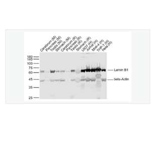 Anti-Lamin B1   antibody-核纤层蛋白B抗体(细胞核膜标志物),Lamin B1