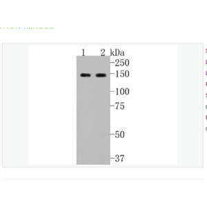 Anti-GLI1 antibody-脑胶质瘤相关蛋白重组兔单克隆抗体,GLI1