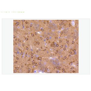 Anti-phospho-GSK3 Alpha + Beta antibody-磷酸化糖原合酶激酶3α/β重组兔单克隆抗体,phospho-GSK3 Alpha + Beta (Tyr279+Tyr216)