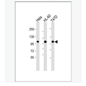 Anti-EZH2 antibody-抑癌蛋白EZH2单克隆抗体
