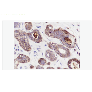 Anti-GCDGP15  antibody-囊性组织液体蛋白15重组兔单克隆抗体