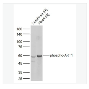 Anti-phospho-AKT1  antibody-磷酸化蛋白激酶AKT1抗体