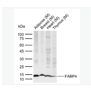 Anti-FABP4 antibody-脂肪细胞型脂肪酸结合蛋白4重组兔单克隆抗体