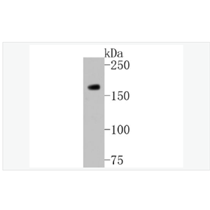 Anti-HDAC9 antibody-组蛋白去乙酰化酶9重组兔单克隆抗体