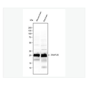 Anti-SNAP25 antibody-突触相关蛋白25重组鼠单克隆抗体
